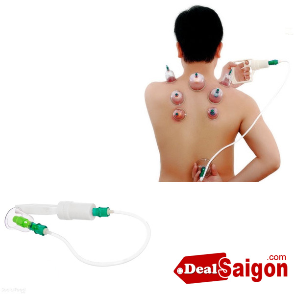 bộ giác hơi không dùng lửa bo giac hoi khong dung lua